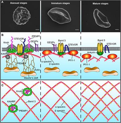 Erythrocyte Membrane Makeover by Plasmodium falciparum Gametocytes